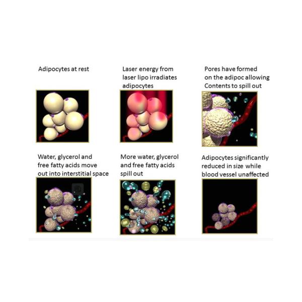 1000mw Lipo Laser Slimming Machine 650nm & 980nm User Friendly Designed