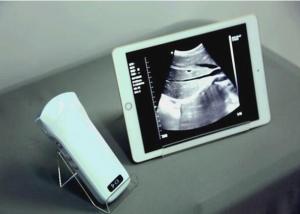 Wholesale Windows Pocket Ultrasound Scanner Machines Electronic Phased Array from china suppliers