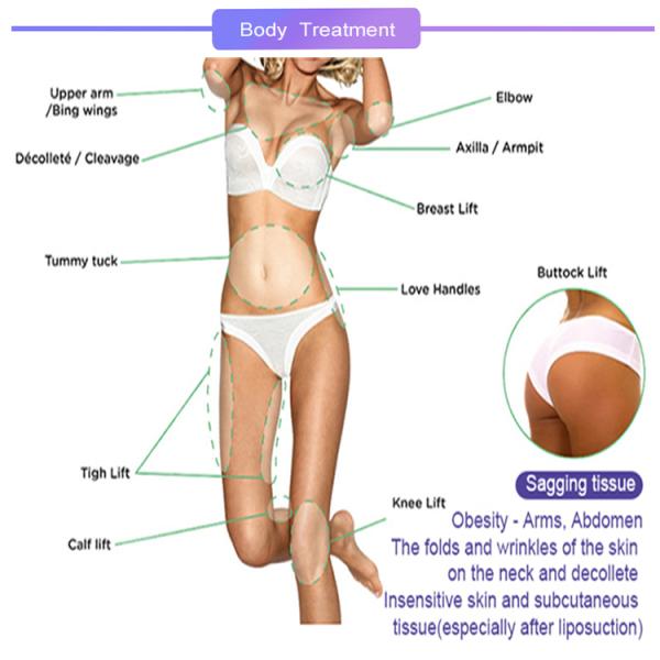 Cosmetic Thread COG Collagen Lifting Barbed Suture Thread PCL Face Lifting Hilos Tensores