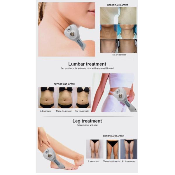 DS-35 Ultrasonic Radio Frequency Machines 300W Body Slimming Body Shaping