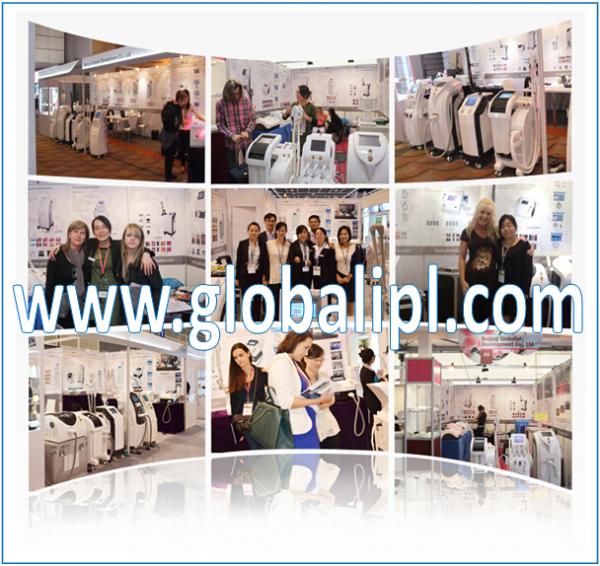 Globalipl 2018 Professional CE Approved Fractional CO2 Laser Acne Treatment Machine/Acne Laser