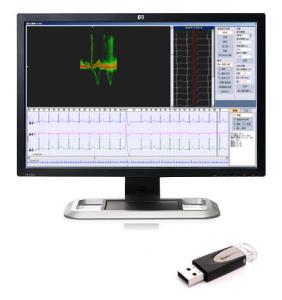 Holter ECG Workstation W/ EKG Holter Monitor and ECG Analyzer Software iTengo OEM