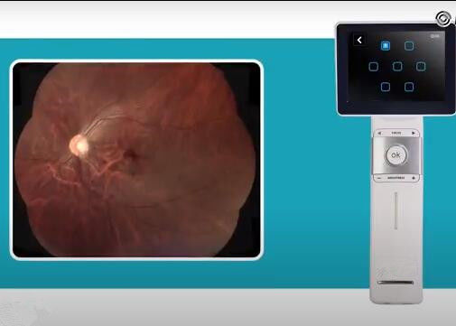 Resolution 2560 X 1920 Pixels Digital Fundus Camera 40° Manual Focus Portable Fundus Camera