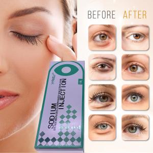 Wholesale Hyamely Removing Dark Circles Injection Filling Tear Troughs 1ml from china suppliers