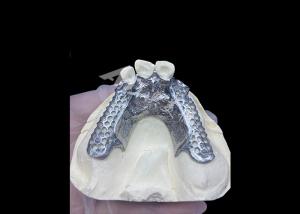 Wholesale Easy Fit Custom Cast Partial Denture Stable and Natural-looking Framework for Fast Results from china suppliers