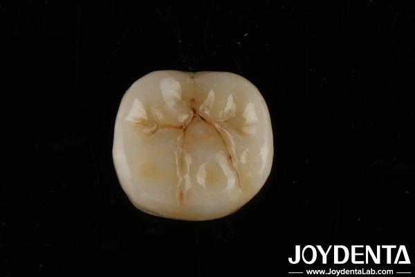 Quality High Translucency Full Zirconia With Layers Biocompatibility And Flexural Strength Of 800 MPa for sale