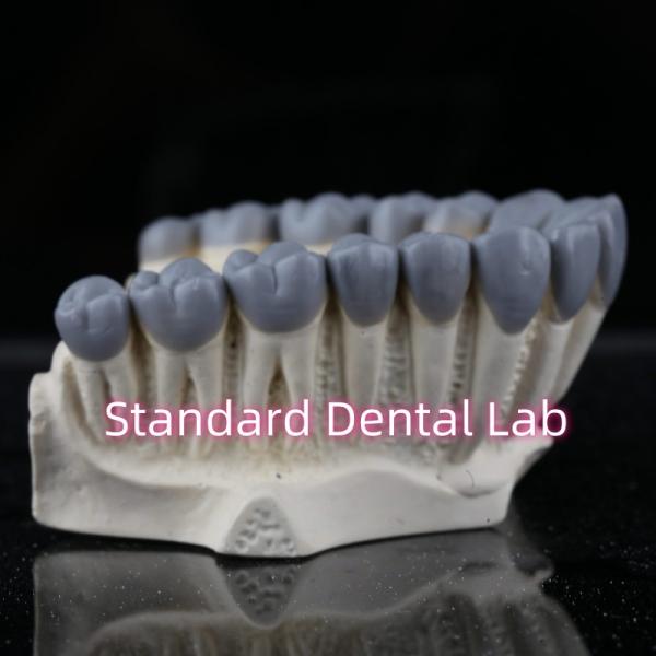 SDL Dental Lab Digital Diagnostic Wax Ups Crown Bridge