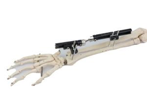Wholesale Sterilized Bone Fracture Distal Radius External Fixator from china suppliers