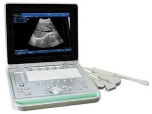 Wholesale 3D Digital Laptop Portable Ultrasound Scanner With All Kinds of Probe from china suppliers