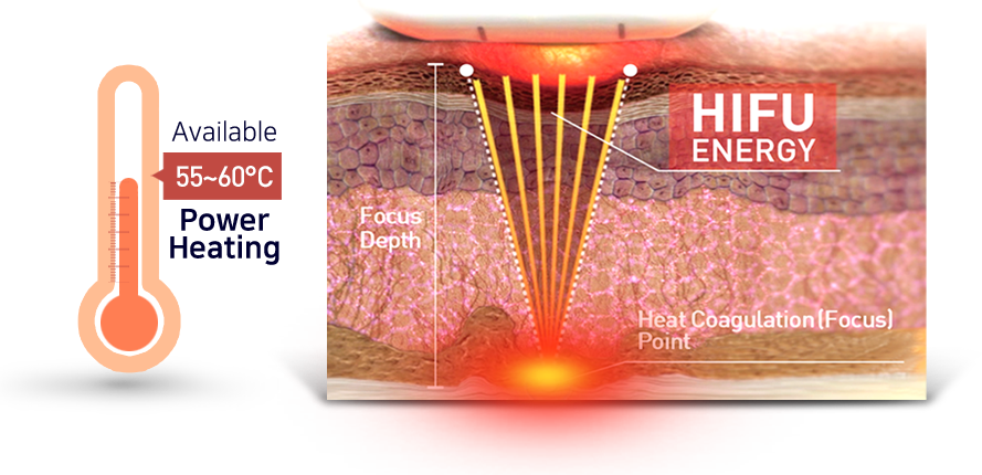 Skin Tightening 27000 Shots 7 Cartridges HIFU Facial Machine