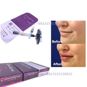 Wholesale 2×1ml Injectable Dermal Filler Juvederm Syringe Ultra3 Ultra4 Voluma from china suppliers
