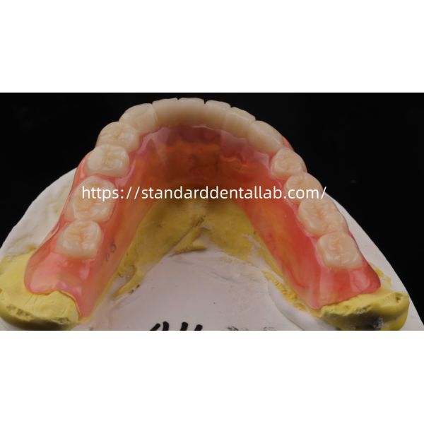 High Esthetics Dental TCS Valplast Flexible Partial Dentures Dental Lab Valplast Clasp Pink Shade