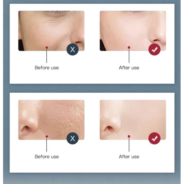 Professional Photon 7 Colors PDT Led Light LED Facial Mask Machine For Skin Rejuvenation Light Therapy