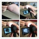 Electronic Video Dermatoscope Microscope Skin Hair Checker 3 Inch TFT Color