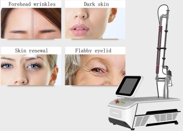 Quality Portable Fractional Co2 Laser Equipment Carbon Dioxide Lasers For Wrinkle Removal for sale