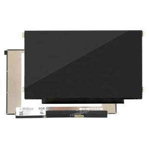 Wholesale 15.6 Inch OLED Display Module 300 cd/㎡ from china suppliers