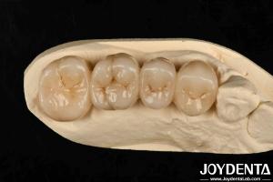 Multilayer Full Zirconia White Style With Layers High Translucency High Resistance To Cracking