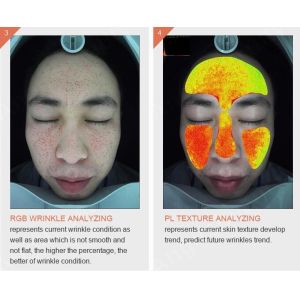 Wholesale Handheld Wireless Wifi 3d Skin Analysis Machine Digital With Video Microscope from china suppliers