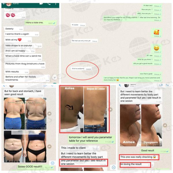 690 nm LED Vacuum Roller Cavitation RF Slimming Machine With RF Power 50 Watt 13.6 MHz