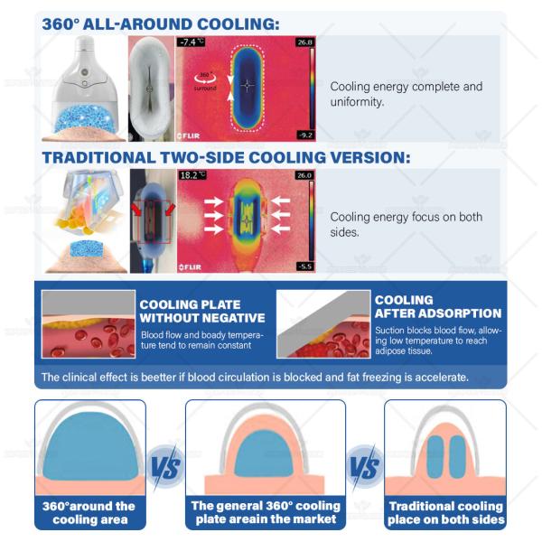 Fat Freezing Slimming Machine 4 Handles 6 Heads For Weight Loss AC 110V/220V 50-60 Hz