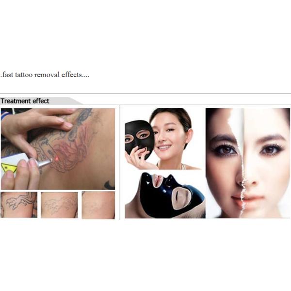 3 In 1 Q Switch ND Yag Laser Machine Tattoo Removal OEM ODM Services