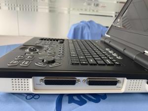 China ISO Mobile Portable Ultrasound Scan Machine MSK GYN Measures on sale