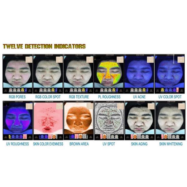 Multi Languages Portable Wrinkle Analysis Shooting Analyzing Displaying 3 In 1