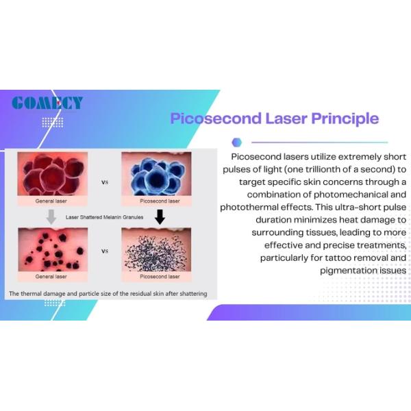 Adjustable 1-10Hz Pulse Repetition Rate Pico Laser for Tattoo Removal and Nd Yag Laser with Air Cooling System