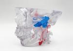 High Performance Biocompatible Resin 3D Printing Service Cnc Plastic Prototype