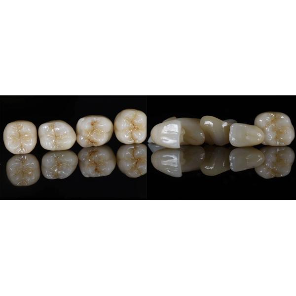 98x10mm White 1200MPA Dental Zirconia Blank For Lab