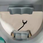 Dynamic Perimetry Test Machine Field Vision Detection