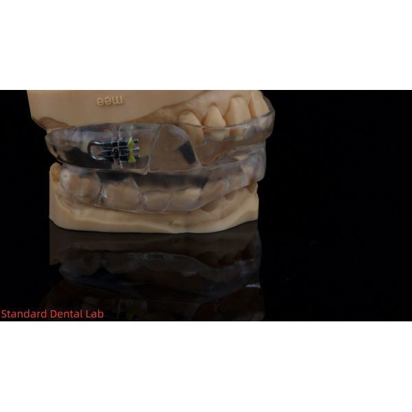 Customizable Dorsal Sleep Appliance Anti Snoring Device For Restful Sleep China Dental Lab