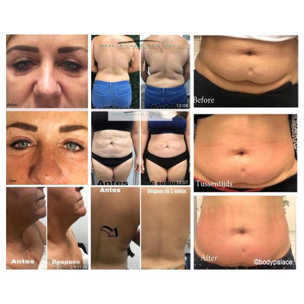 690 nm LED Vacuum Roller Cavitation RF Slimming Machine With RF Power 50 Watt 13.6 MHz