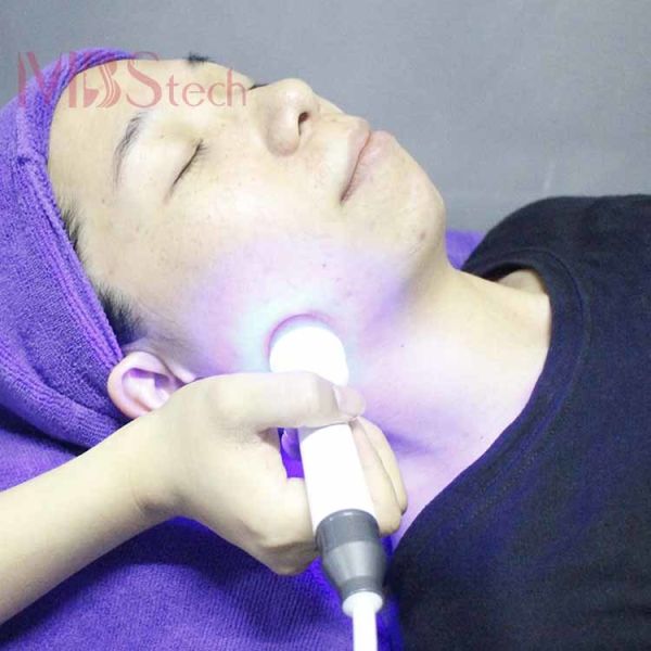 Oxygen Jet Peel Multipolar Rf Hydrafacial Dermabrasion Machine