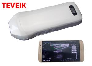 China Wireless USB Ultrasound Linear Probe Electric Protable Medical ultrasound instruments on sale