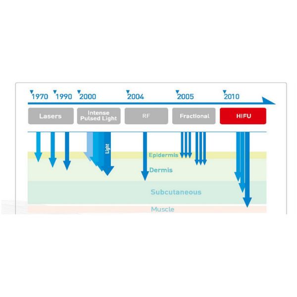 50HZ / 60HZ High Intensity Focused sound Machine For Skin Tightening