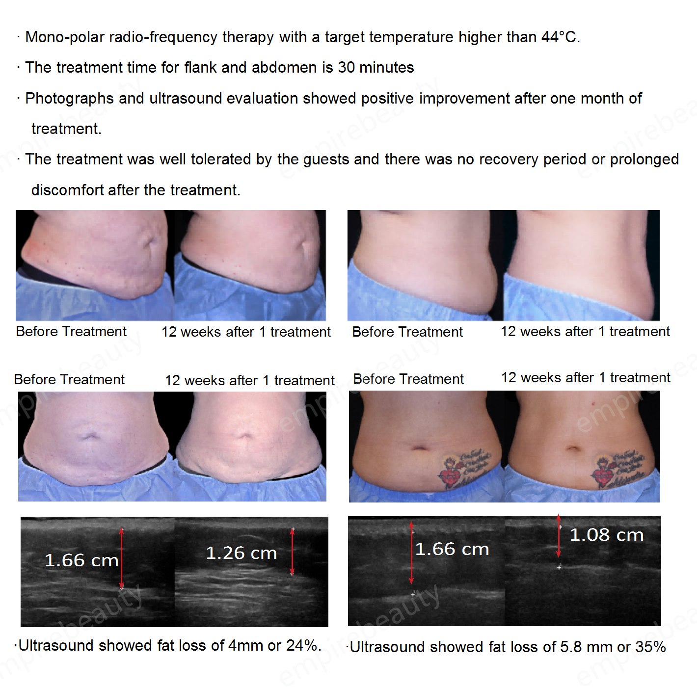 10 - 800W Body Slimming Machine 2MHz Fat Reduction Machine Portable