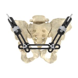 Intra Articular Monolateral External Fixator Precise Single Arm External Fixator
