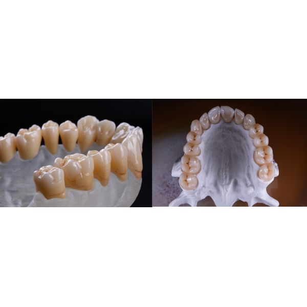 98x10mm White 1200MPA Dental Zirconia Blank For Lab